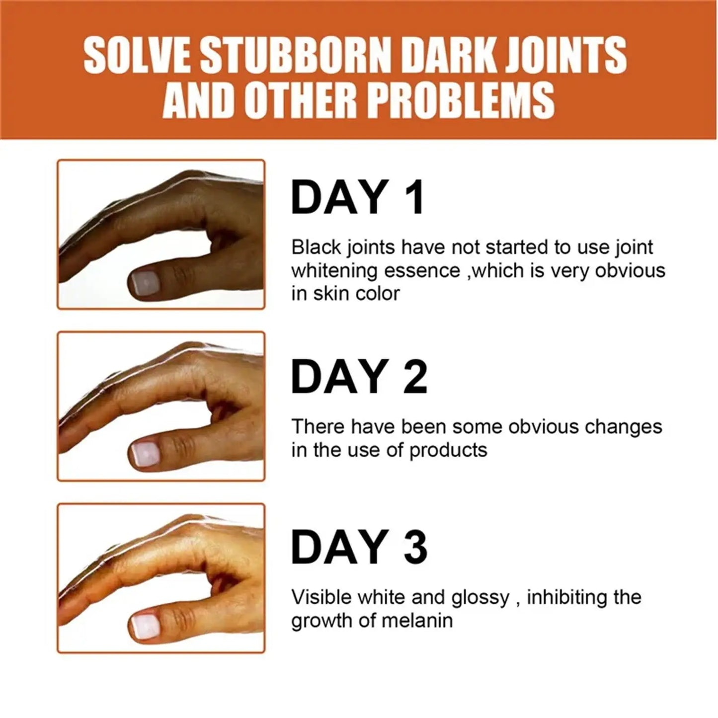 Dark Knuckles /Serum Elbows Hand Knuckle Stains Remover Essence
