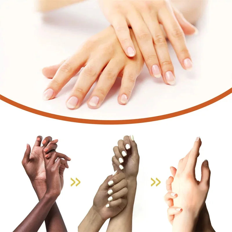 Dark Knuckles /Serum Elbows Hand Knuckle Stains Remover Essence