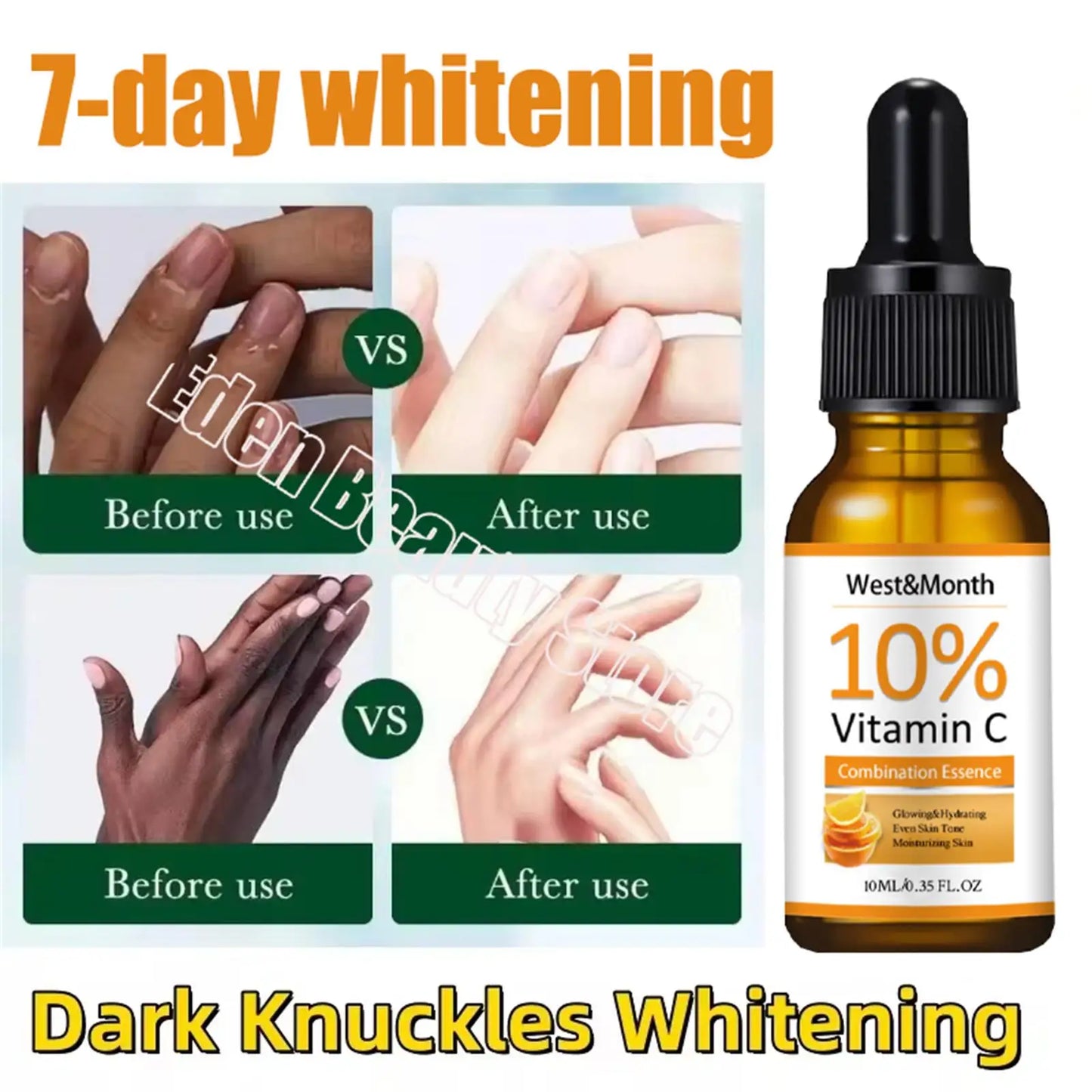 Dark Knuckles /Serum Elbows Hand Knuckle Stains Remover Essence