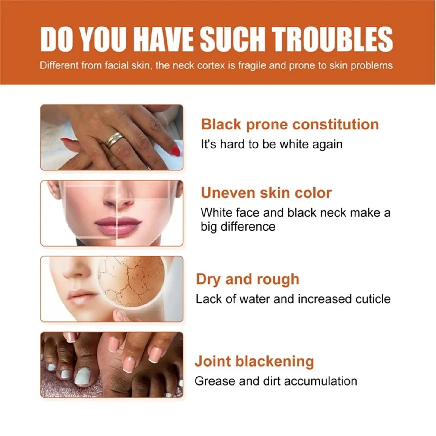 Dark Knuckles /Serum Elbows Hand Knuckle Stains Remover Essence