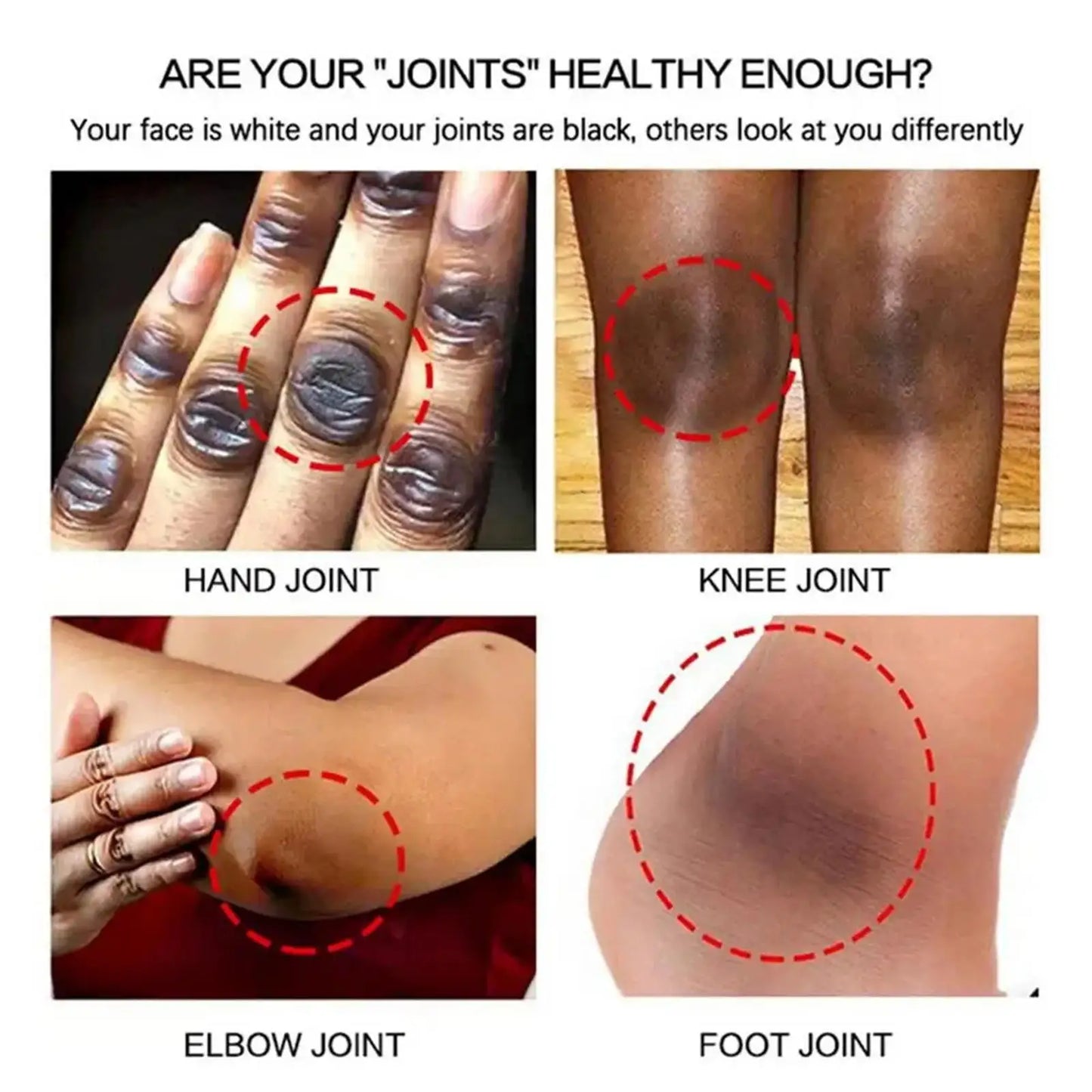 Dark Knuckles /Serum Elbows Hand Knuckle Stains Remover Essence