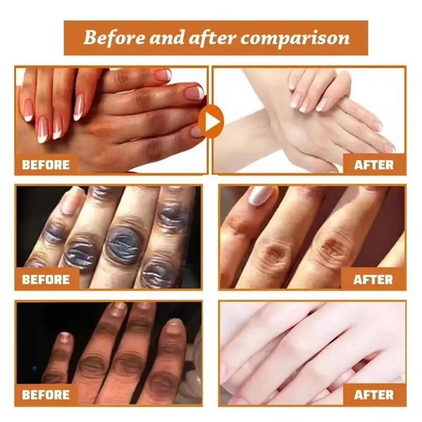 Dark Knuckles /Serum Elbows Hand Knuckle Stains Remover Essence