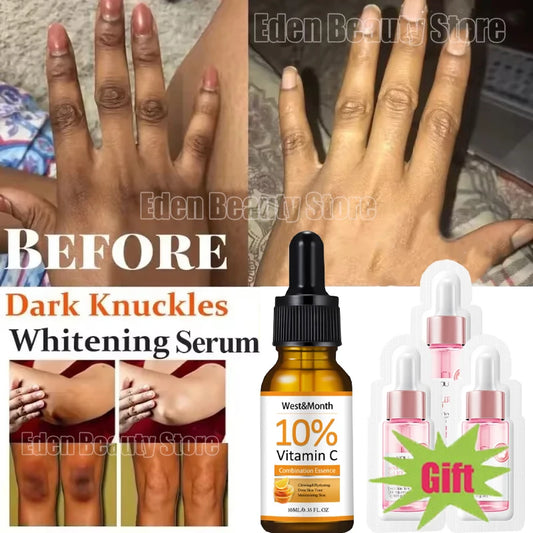 Dark Knuckles /Serum Elbows Hand Knuckle Stains Remover Essence